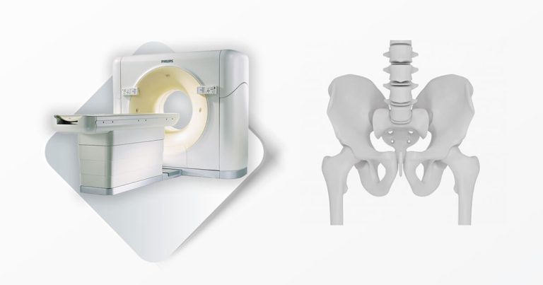 Magnetna rezonanca MSCT Kragujevac - Multislajsni skener