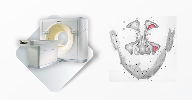 Magnetna rezonanca MSCT Kragujevac - Multislajsni skener